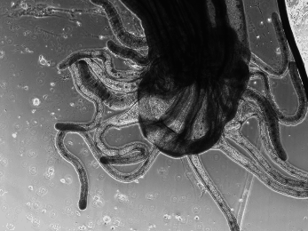 Nematostella vectensis moving its tentacles, phase contrast time lapse